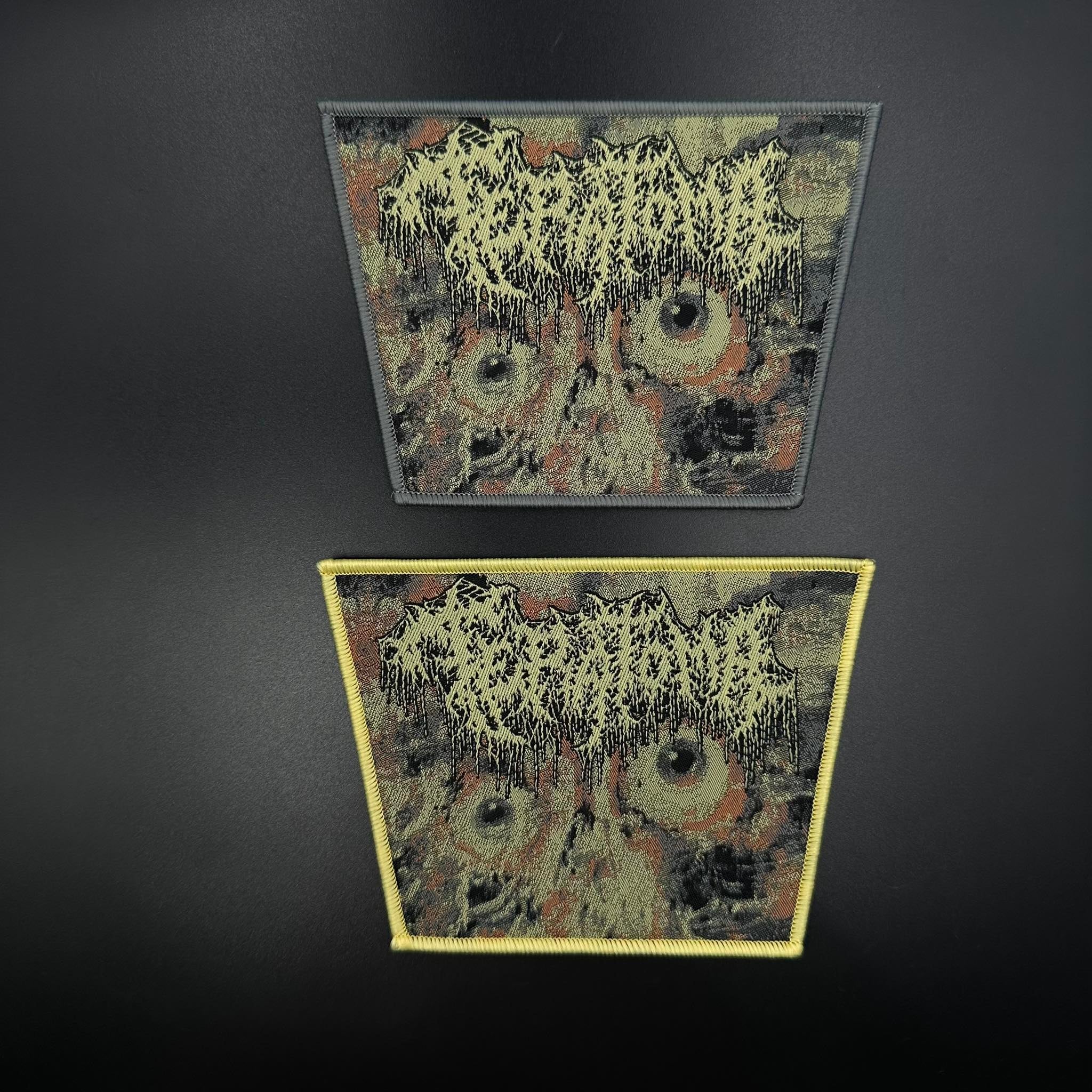 Teratoma - Purulent Manifestations - Image 2